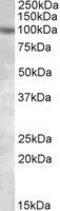 Polycystin 2, Transient Receptor Potential Cation Channel antibody, GTX88317, GeneTex, Western Blot image 