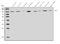 Chloride Voltage-Gated Channel 5 antibody, A02286-2, Boster Biological Technology, Western Blot image 