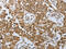 Proteasome 26S Subunit, Non-ATPase 6 antibody, CSB-PA953040, Cusabio, Immunohistochemistry paraffin image 