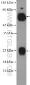 Human IgG antibody, 10284-1-AP, Proteintech Group, Western Blot image 