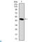 Delta Like Non-Canonical Notch Ligand 1 antibody, LS-C812570, Lifespan Biosciences, Western Blot image 