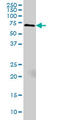 Myristoylated Alanine Rich Protein Kinase C Substrate antibody, LS-B5450, Lifespan Biosciences, Western Blot image 