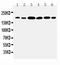 Laminin Subunit Gamma 1 antibody, PA1581, Boster Biological Technology, Western Blot image 