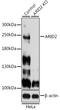 AT-rich interactive domain-containing protein 2 antibody, GTX35240, GeneTex, Western Blot image 