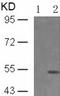 Phosphatase And Tensin Homolog antibody, TA323700, Origene, Western Blot image 