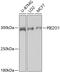 Piezo Type Mechanosensitive Ion Channel Component 1 antibody, GTX66441, GeneTex, Western Blot image 