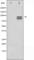 Gys3 antibody, abx010876, Abbexa, Western Blot image 