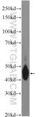 Complement Component 4 Binding Protein Beta antibody, 15837-1-AP, Proteintech Group, Western Blot image 