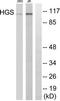 Hepatocyte Growth Factor-Regulated Tyrosine Kinase Substrate antibody, TA312168, Origene, Western Blot image 