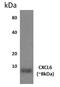 C-X-C Motif Chemokine Ligand 6 antibody, GTX52670, GeneTex, Western Blot image 