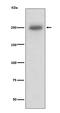 Laminin-1 subunit beta antibody, M03894, Boster Biological Technology, Western Blot image 