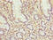 Mitochondrial Ribosomal Protein L51 antibody, LS-C395641, Lifespan Biosciences, Immunohistochemistry paraffin image 