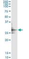 Glutamate Dehydrogenase 2 antibody, H00002747-M01, Novus Biologicals, Immunoprecipitation image 