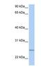 Intraflagellar Transport 27 antibody, NBP1-58928, Novus Biologicals, Western Blot image 