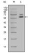 Keratin 5 antibody, GTX83135, GeneTex, Western Blot image 