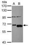 AKT Serine/Threonine Kinase 2 antibody, GTX111612, GeneTex, Western Blot image 