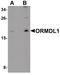 ORMDL Sphingolipid Biosynthesis Regulator 1 antibody, PA5-21146, Invitrogen Antibodies, Western Blot image 