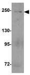 Myosin Heavy Chain 3 antibody, GTX32147, GeneTex, Western Blot image 