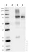 Carnitine Palmitoyltransferase 1A antibody, ab128568, Abcam, Western Blot image 