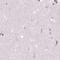 Galactose Mutarotase antibody, PA5-57285, Invitrogen Antibodies, Immunohistochemistry paraffin image 