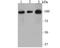 PHD Finger Protein 8 antibody, NBP2-76957, Novus Biologicals, Western Blot image 