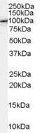 Amyloid Beta Precursor Protein Binding Family B Member 1 antibody, GTX89278, GeneTex, Western Blot image 