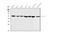 Zeta Chain Of T Cell Receptor Associated Protein Kinase 70 antibody, M01857-3, Boster Biological Technology, Western Blot image 
