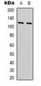 Ribosomal Protein S6 Kinase C1 antibody, orb318874, Biorbyt, Western Blot image 