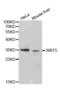 Sirtuin 5 antibody, abx004431, Abbexa, Western Blot image 