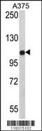 Tectonin Beta-Propeller Repeat Containing 1 antibody, 62-496, ProSci, Western Blot image 