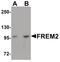 FRAS1 Related Extracellular Matrix 2 antibody, PA5-20982, Invitrogen Antibodies, Western Blot image 