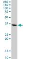 Chimerin 1 antibody, H00001123-M03, Novus Biologicals, Western Blot image 