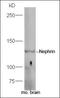 NPHS1 Adhesion Molecule, Nephrin antibody, orb157949, Biorbyt, Western Blot image 