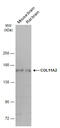 Collagen Type XI Alpha 2 Chain antibody, GTX629739, GeneTex, Western Blot image 