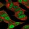Cyclin Dependent Kinase 5 antibody, NBP2-55870, Novus Biologicals, Immunofluorescence image 