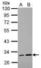 Leucine Rich Repeat Containing 19 antibody, NBP2-17167, Novus Biologicals, Western Blot image 