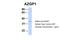 Alpha-2-Glycoprotein 1, Zinc-Binding antibody, PA5-44912, Invitrogen Antibodies, Western Blot image 