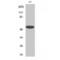 Inositol Hexakisphosphate Kinase 3 antibody, LS-C384134, Lifespan Biosciences, Western Blot image 