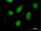 Regulator Of Solute Carriers 1 antibody, H00006248-B01P, Novus Biologicals, Immunofluorescence image 