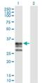 ICAM-4 antibody, H00003386-D01P, Novus Biologicals, Western Blot image 