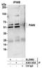 Paired box protein Pax-6 antibody, A305-303A, Bethyl Labs, Immunoprecipitation image 