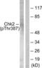 Checkpoint Kinase 2 antibody, LS-C198798, Lifespan Biosciences, Western Blot image 