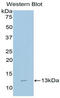 Beta-2-Microglobulin antibody, LS-C302432, Lifespan Biosciences, Western Blot image 