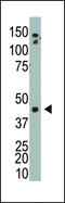 Adenosine Kinase antibody, 62-653, ProSci, Western Blot image 