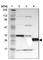 PRELI Domain Containing 1 antibody, HPA005701, Atlas Antibodies, Western Blot image 