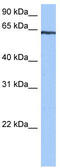 Tetratricopeptide Repeat Domain 6 antibody, TA346680, Origene, Western Blot image 