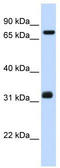 T-Complex 10 antibody, TA346728, Origene, Western Blot image 
