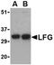 Fas Apoptotic Inhibitory Molecule 2 antibody, orb74416, Biorbyt, Western Blot image 