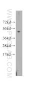 Leucine Rich Repeat Protein 1 antibody, 11628-1-AP, Proteintech Group, Western Blot image 