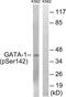 GATA Binding Protein 1 antibody, LS-C117363, Lifespan Biosciences, Western Blot image 